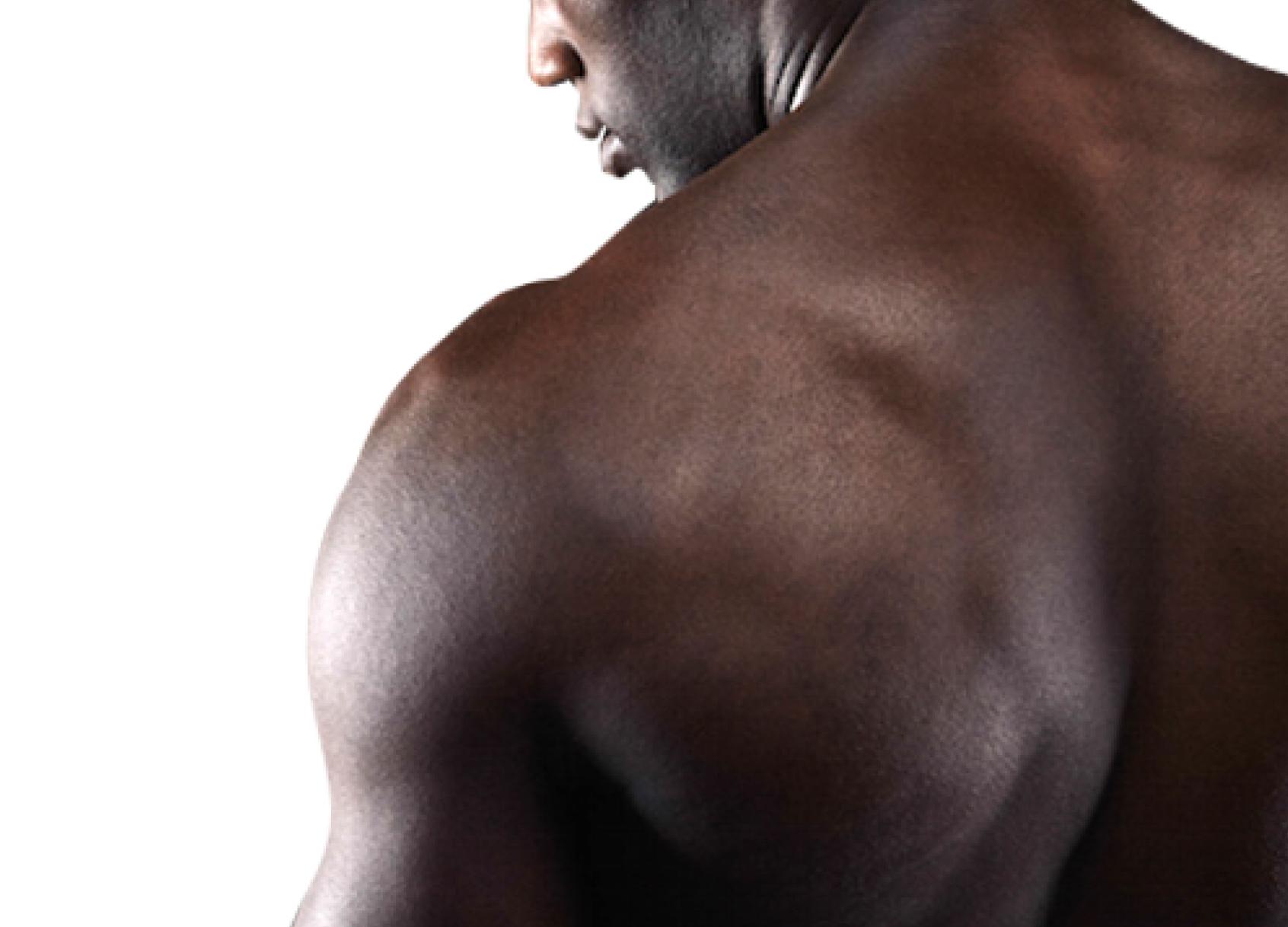 Upper Extremity Pain